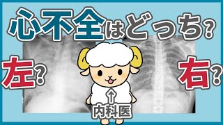 【初心者むけ】心不全で最初に知るべきレントゲン所見5選