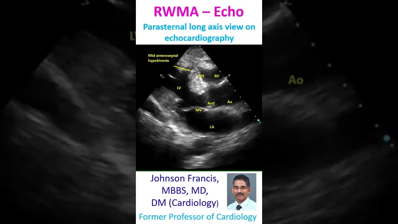 Rwma Echo Youtube