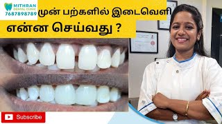 முன் பற்களில் இடைவெளி, என்ன செய்வது? #chennai #adyar #drjayalaksmi #mithrandental