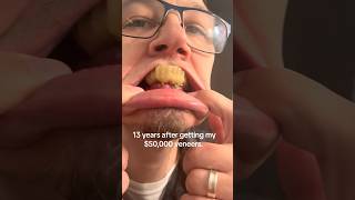 He Spent $50,000 On His Teeth And THIS Happened! 😳🦷