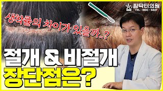 질문 : 모발이식 절개 vs 비절개 결과는? 답 : 차이가 없어야죠! (경험 많고 실력있는 의사가 정답!)  [참닥터의원]