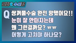 쌍수 후 눈이 잘 안떠진다? 이유와 개선방법 [열린수신함 50편]