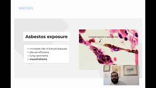 Asbestos Exposure Diagnosis - Module: By Ariel Gershon MD