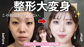 【大変身】”この顔で生きれない。”整形で視聴者さんを仰天チェンジ！