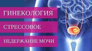 Стрессовое недержание мочи у женщин | Добрый Прогноз