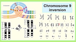 chromosome 9 inversion