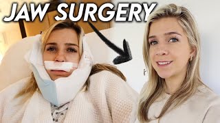 My Jaw Surgery Experience | Before & After 3 Months Post Op