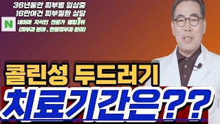 4K)콜린성 두드러기 치료기간은? 콜린성 두드러기 치료방법? 콜린성 두드러기 원인은?