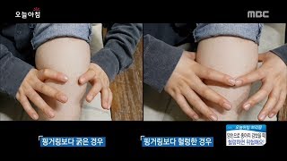 [Morning Show]Check my legs too! 내 다리도 검사해보세요! [생방송 오늘 아침] 20171114