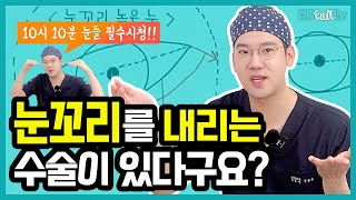 더블픽스 듀얼트임으로 눈꼬리 내리는 방법?