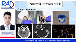 Kỹ thuật chụp cắt lớp vi tính sọ mạch não và những lưu ý khi chụp