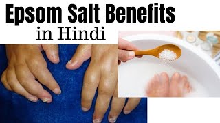 Epsom salt benefits in Hindi | epsom salt kya hai ?