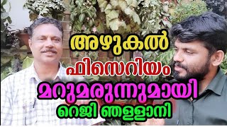 അഴുകലിനും ഫിസെറിയത്തിനും ഇനി ഗുഡ് ബൈ... l reji njallani l jomon rajakad l