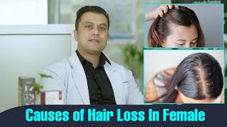 Female Hair Loss: Causes & Treatment || Dr.Rupak Ghimire