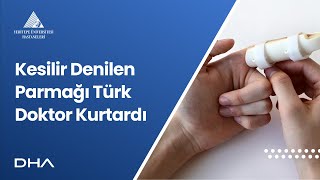 Kesilir Denilen Parmağı Türk Doktor Kurtardı