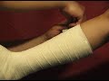 How to apply PrimeSplint (Leg)