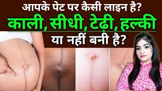 Pregnancy me Pet Par Line Kab Banti Hai l Linea Nigra During Pregnancy l Pregnancy me Nabhi