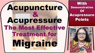 Get Instant Relief From  Migraine With Acupuncture & Acupressure (With Demo Of The Points)