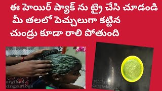 తలలో చుండ్రు పెచ్చులుగా కట్టి ఉన్న సరే|| ఈ ప్యాక్ ఒక్కసారి వేసుకుంటే100% పర్సెంట్ పోతుంది