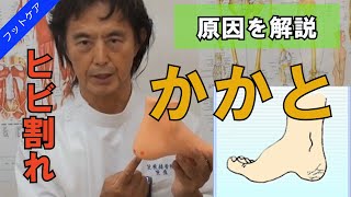 【症状と原因】かかとのヒビ割れ