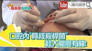 《最新研究　大腸癌和口腔健康有關！》【2019.10.31『1600ㄟ播新聞尚健康』】