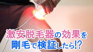 超激安の脱毛器は効果があるのか？剛毛で検証 #shorts