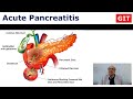 Acute Pancreatitis (GIT) - Internal Medicine