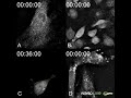 Label-free live cell imaging of different cell death types