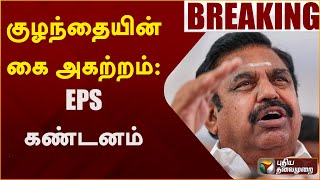 #BREAKING: குழந்தையின் கை அகற்றம்: EPS கண்டனம் | EPS | AIADMK | Puthiya Thalaimurai