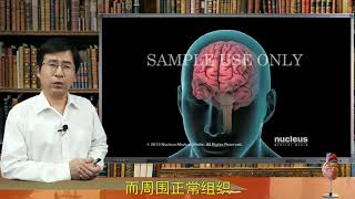 三维适形调强放疗听过吗？和传统放疗有何不同？70%恶性肿瘤患者都需要接受放疗