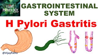 H Pylori Gastritis : Epidemiology, Pathogenesis, Clinical features, Sequelae & Treatment
