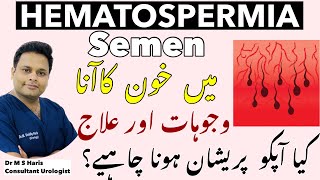 Bloody Surprise in Semen || Hematospermia || Blood in Semen | Causes and Treatment of Blood in semen