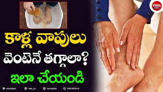 కాళ్ల వాపులు వెంటెనే తగ్గాలా !ఇలా చేయండి | Natural Home remedy For Leg Swelling Problem | VigilMedia