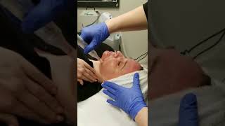 PRP FACIAL REJUVENATION