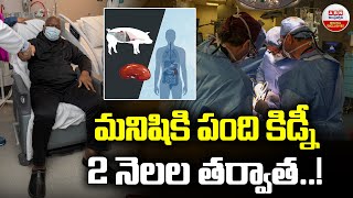 మనిషికి పంది కిడ్నీ..రెండు నెలల తర్వాత..! | Pig Kidney For Man | Digital Exclusives