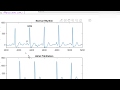 Deep Learning Model to Detect Normal and Abnormal Heartbeat from ECG signal in MATLAB