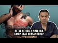 Betul Ke Boleh Mati Bila Kayap Ular Bersambung?