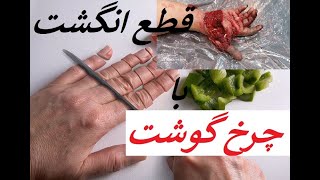 مراقب باش | لحظه قطع شدن انگشت توسط چرخ گوشت +18