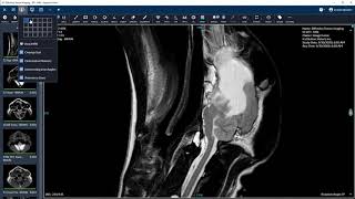 Keystone Hot Key Configuration | Veterinary Image Management Software | Keystone Omni