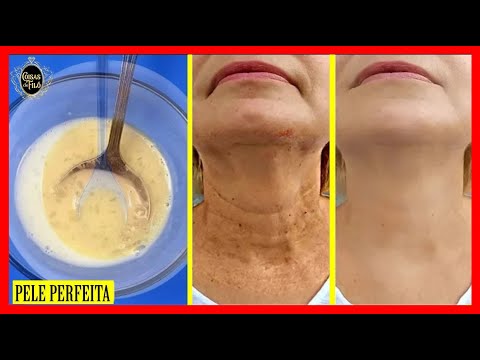 Como Acabar Com As RUGAS E DOBRAS Só Esfregando Essa Mistura - YouTube