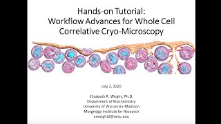 Cryo-CLEM webinar series: No2 - Workflow Advances for Whole Cell Correlative Cryo-Microscopy