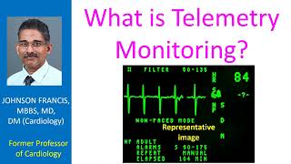 What is Telemetry Monitoring?