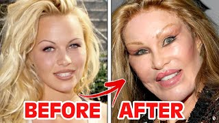 Before And After | Botched Celebrity Plastic Surgery