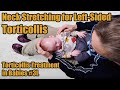 #3L Neck Stretches for Left-sided Torticollis: Torticollis Treatment in Babies