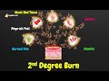 burns symptoms differential diagnosis ddx emergency medicine education