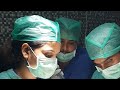 Live Graft Implantation with 