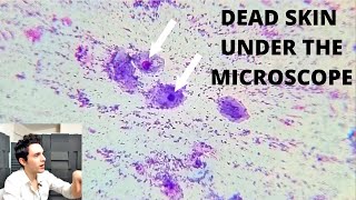 UPDATE Dead Skin Under The Microscope (Part 2)