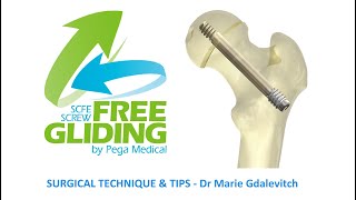 Free-Gliding SCFE Screw - Tips by Dr Marie Gdalevitch