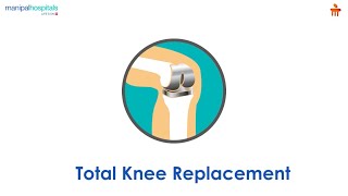 What is Total Knee Replacement? l Manipal Hospitals Bengaluru