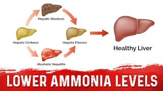 How to Lower Your Ammonia From Liver Cirrhosis - Ammonia Toxicity In Liver – Dr. Berg